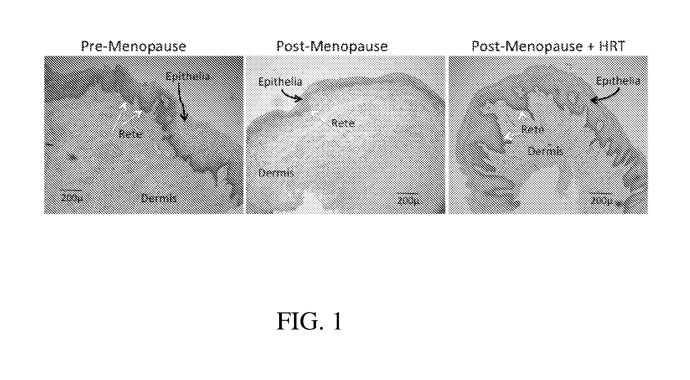 Methods for assessing vaginal atrophy