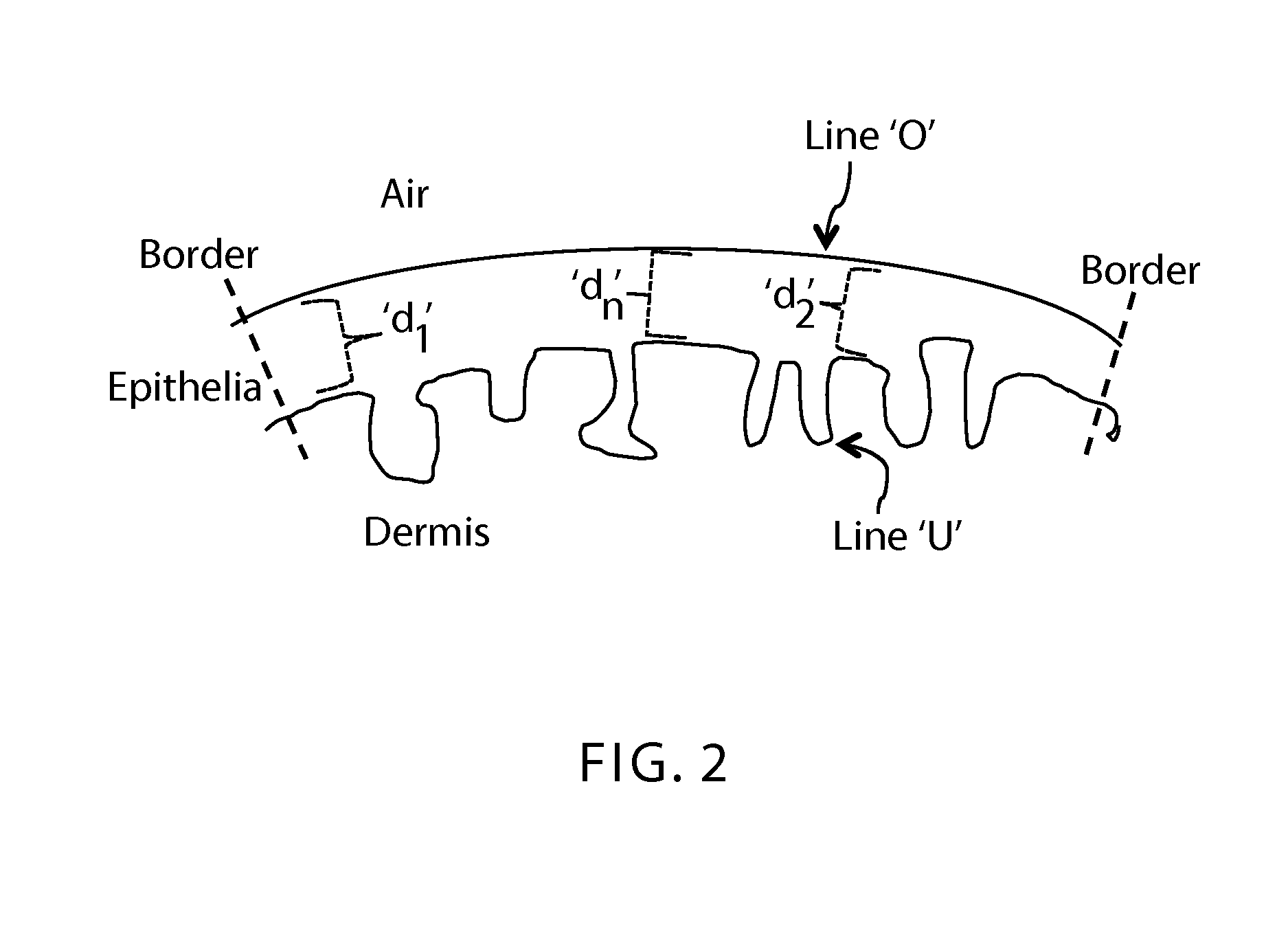 Methods for assessing vaginal atrophy