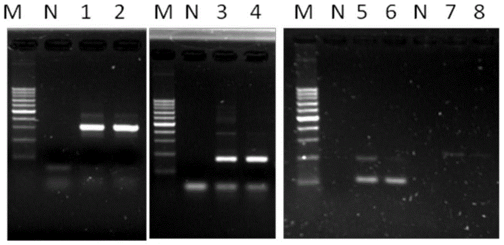 Multiplex pcr detection kit and detection method for new intestinal protozoa