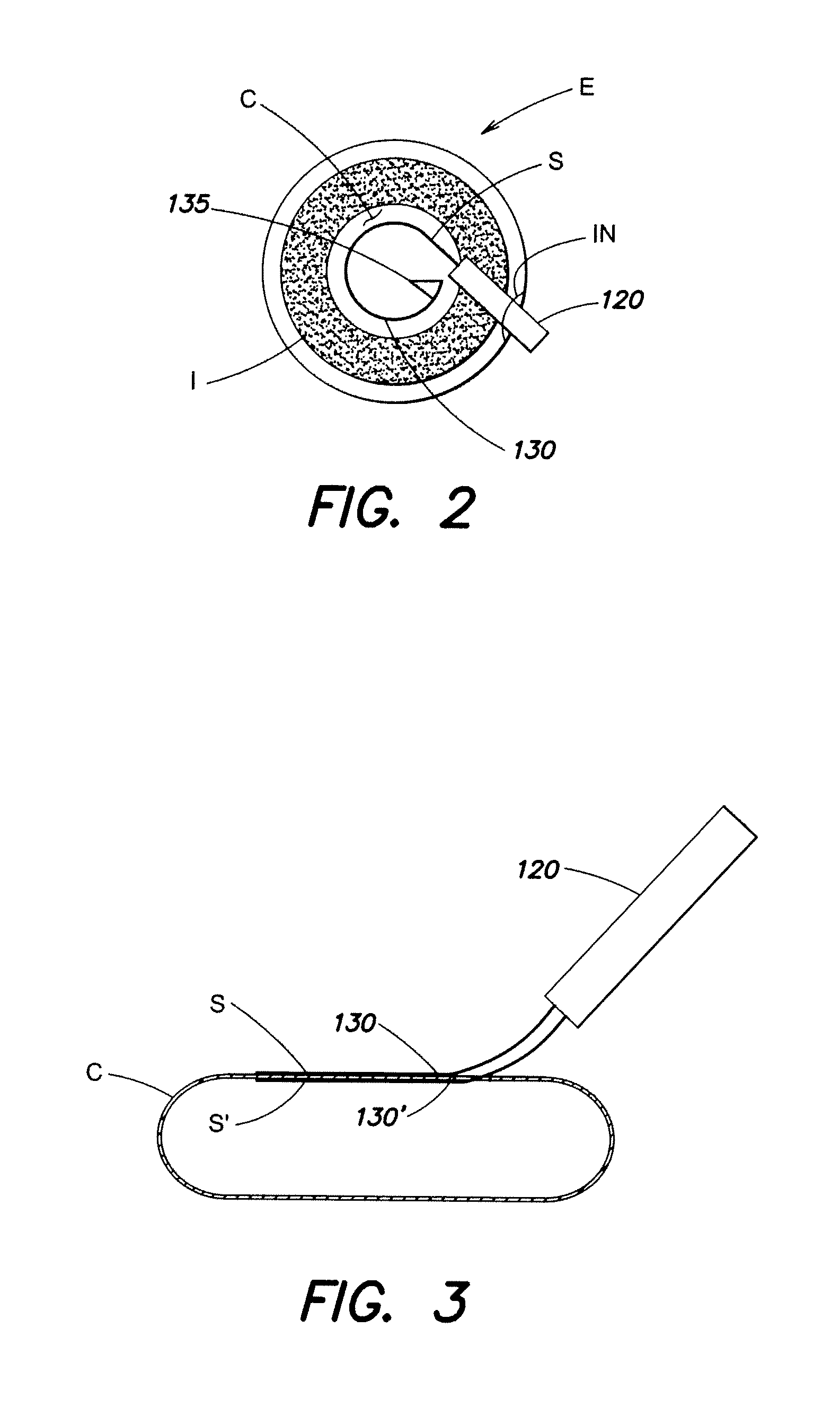 Capsulotomy methods and apparatus using heat