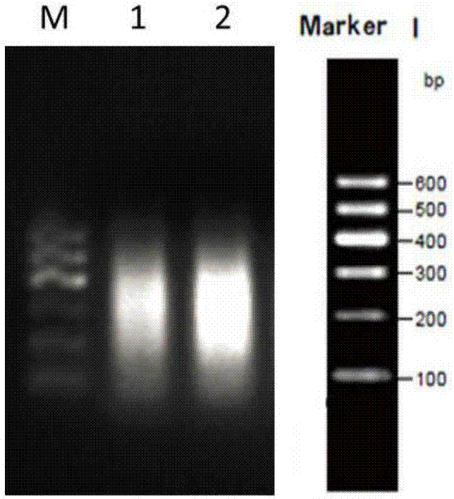 Leukemia B cell minimal residual detection method