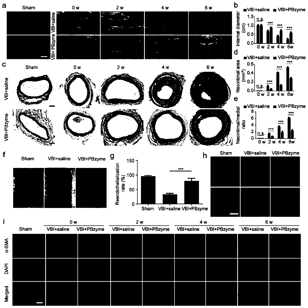 Application of prussian blue in preparation of medicine for treating vascular restenosis