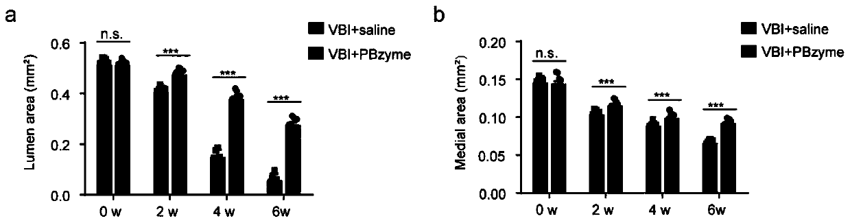 Application of prussian blue in preparation of medicine for treating vascular restenosis