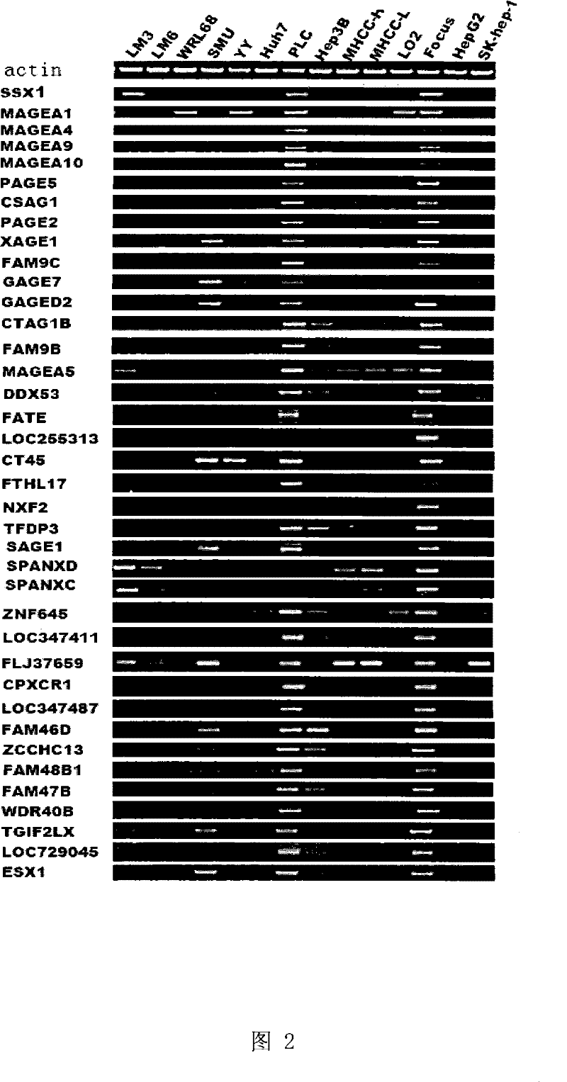 Uses of MAGEA9 gene