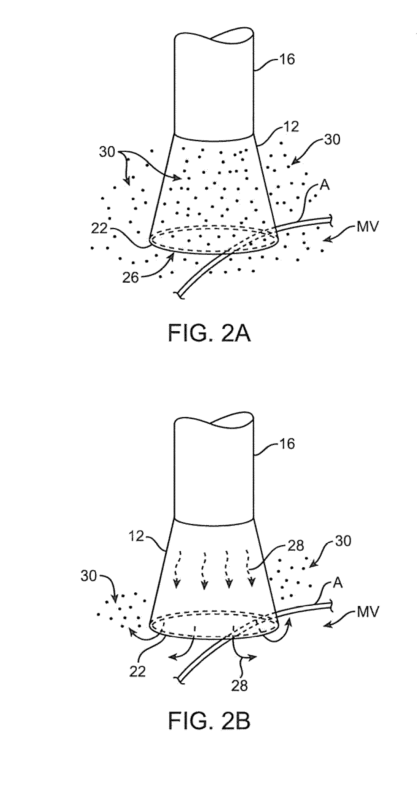 Catheter control systems