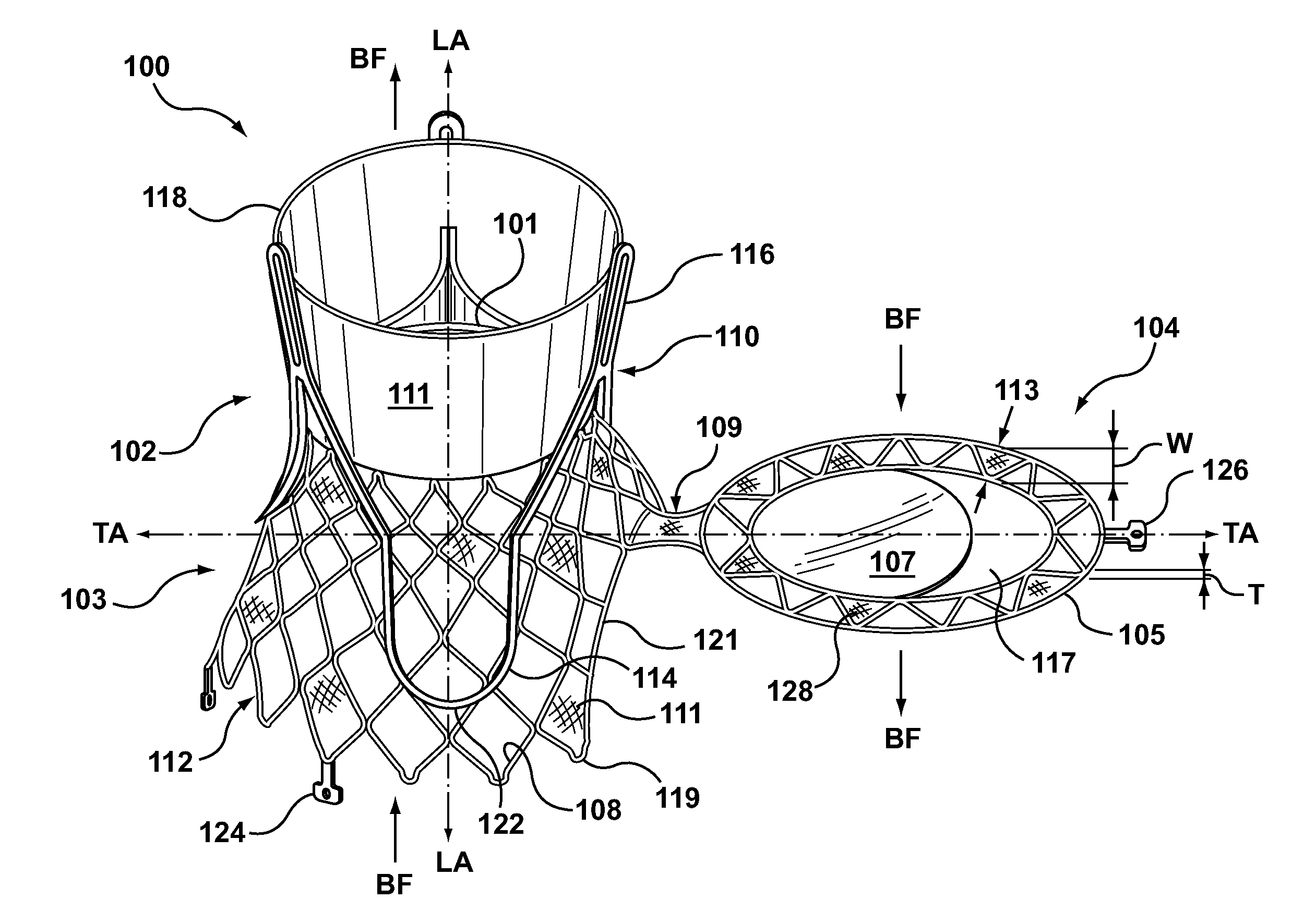 Dual Valve Prosthesis for Transcatheter Valve Implantation