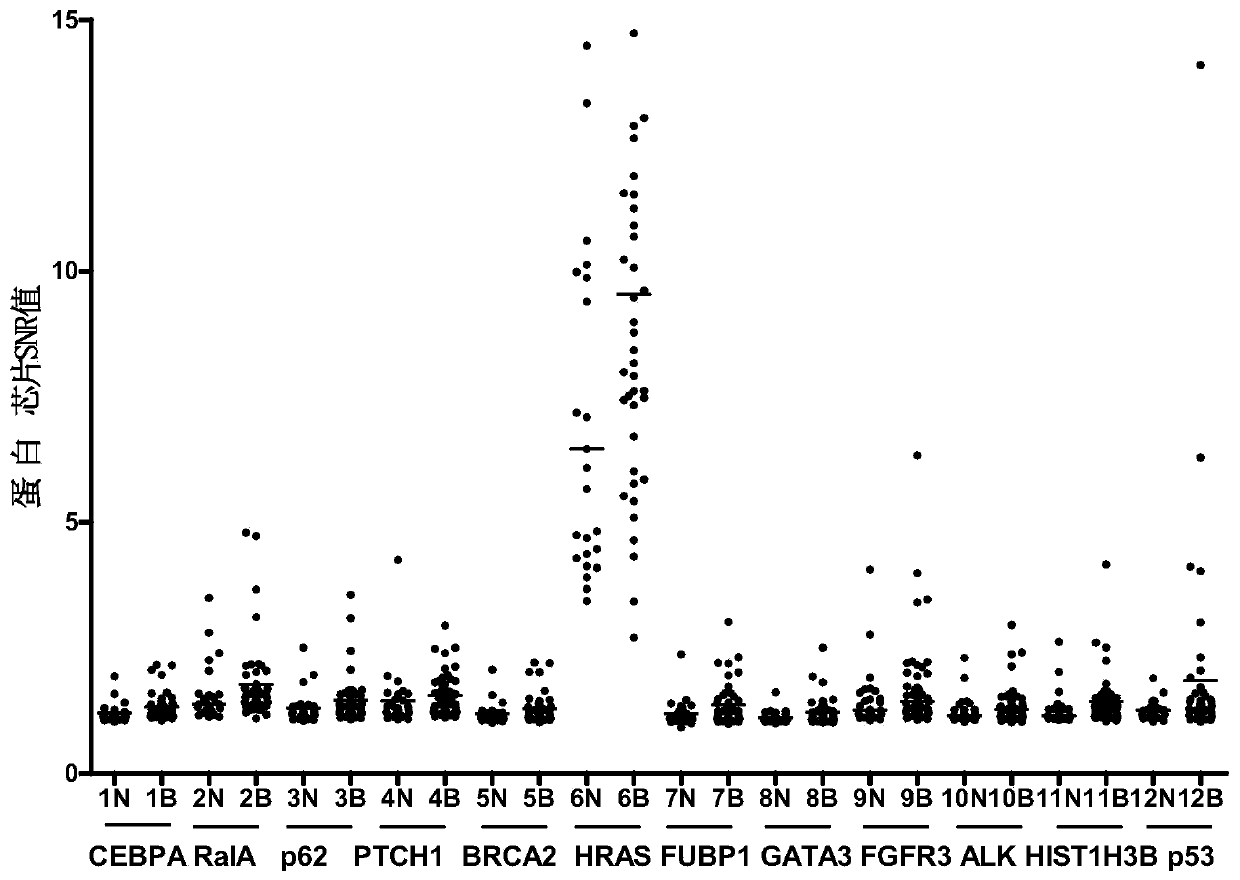 Serum protein marker for early screening and diagnosis of breast cancer, kit and detection method