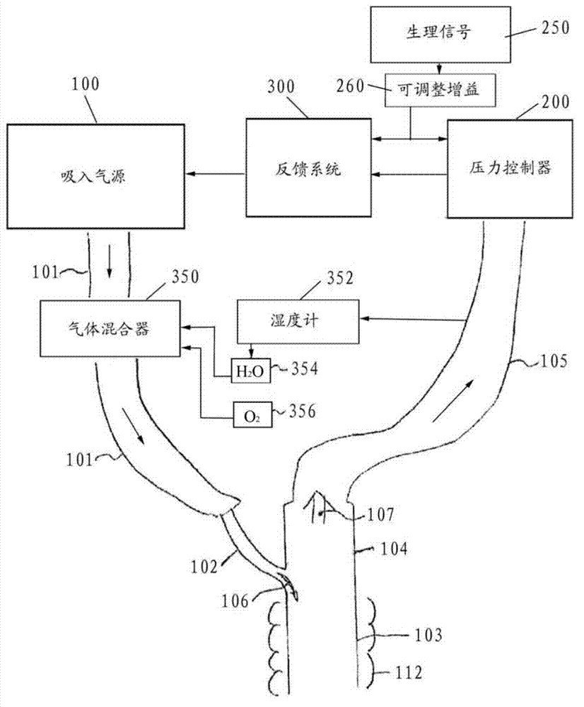 Method and system for patient-synchronized ventilatory assist with endotracheal through-flow