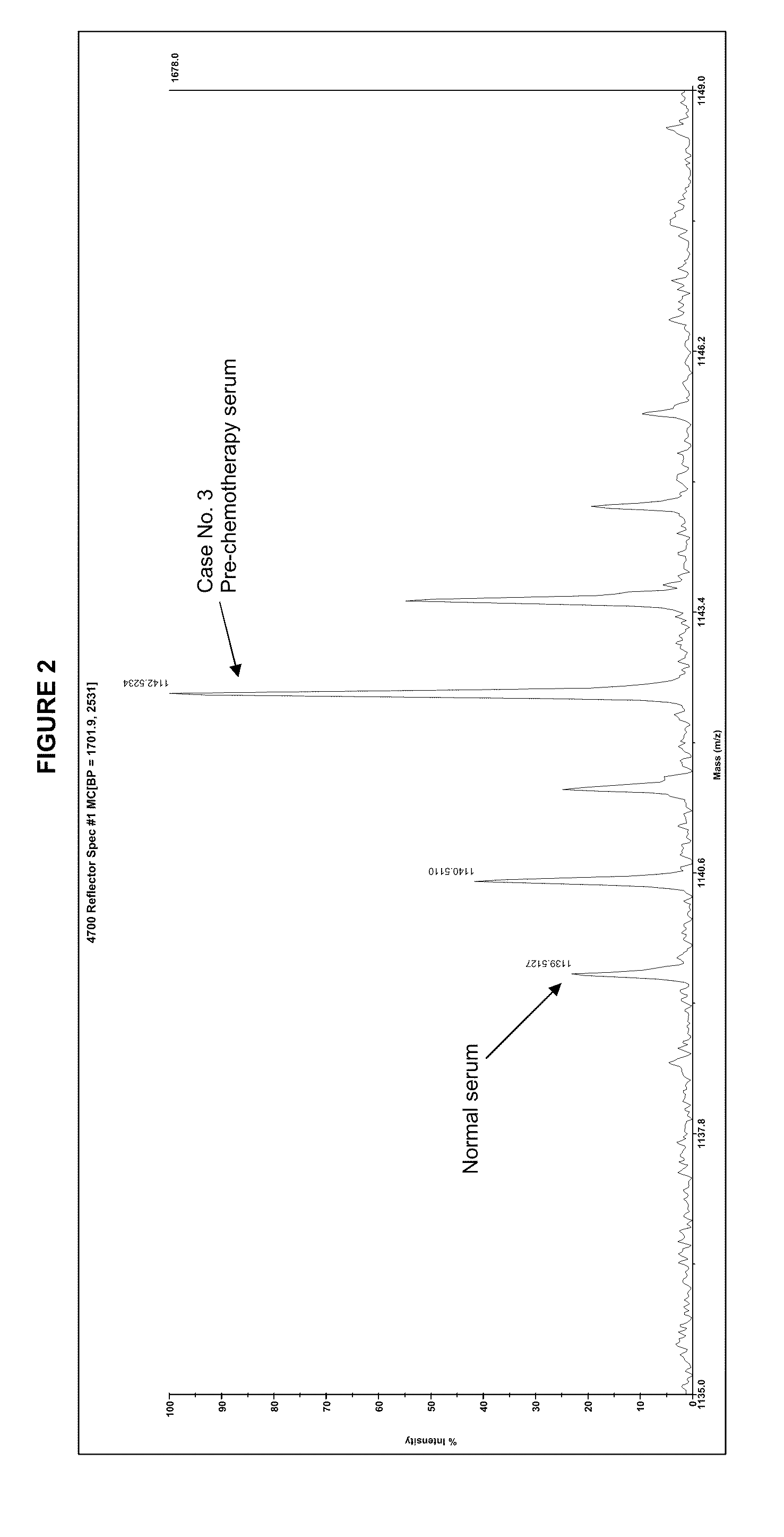 Detection of glycopeptides and glycoproteins for medical diagnostics