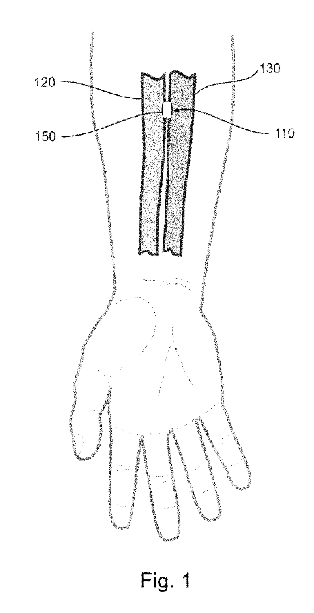 Devices, systems, and methods for peripheral arteriovenous fistula creation