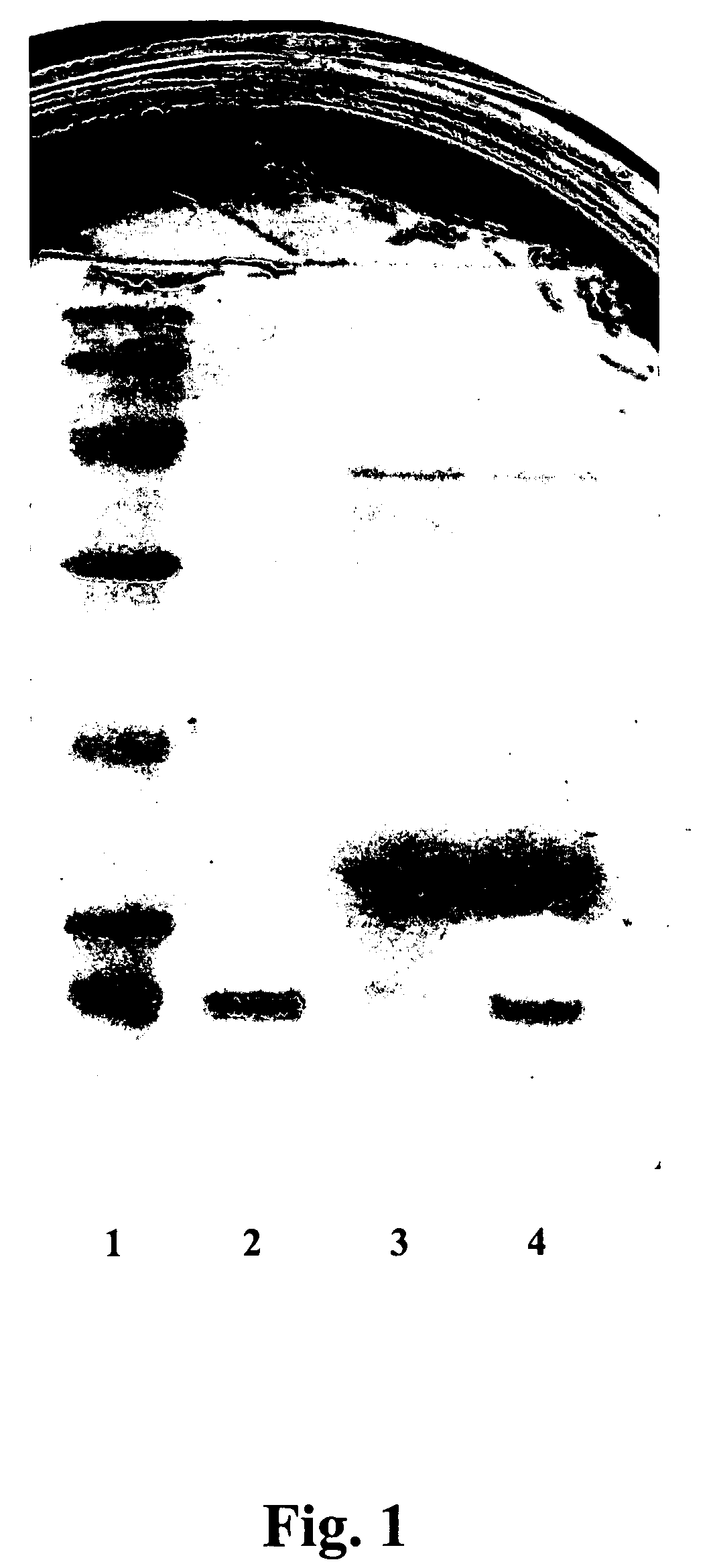 Bacteriocins and novel bacterial strains