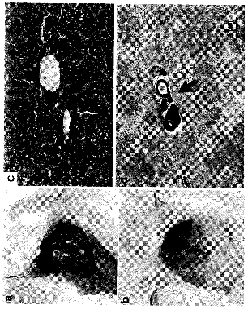 Polyhydroxylated bile acids for treatment of biliary disorders