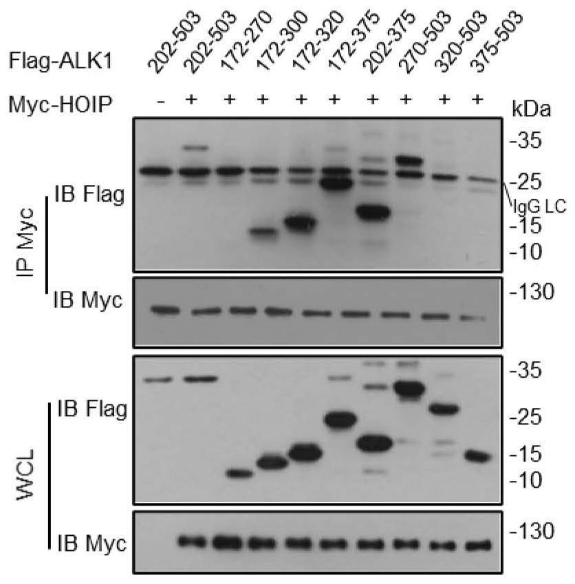 Application of HOIP inhibitor in preparation of medicine for treating type II hereditary hemorrhagic telangiectasia