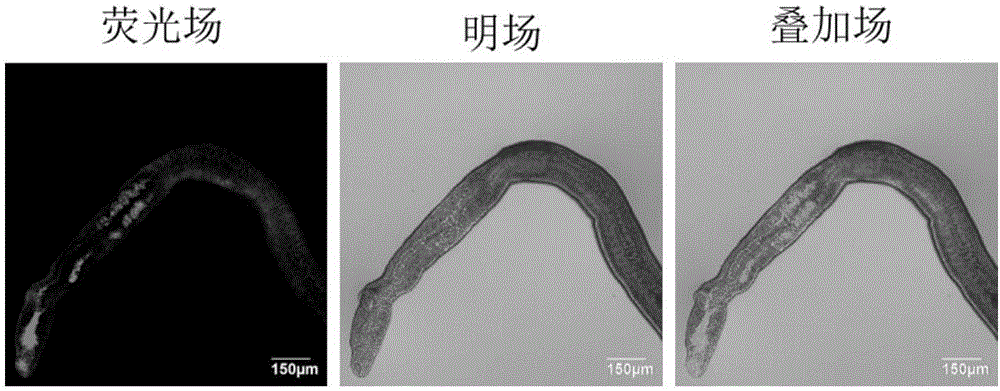 Near-infrared fluorescent dye and synthesis method thereof, and application of near-infrared fluorescent dye in parasite fluorescence labeling