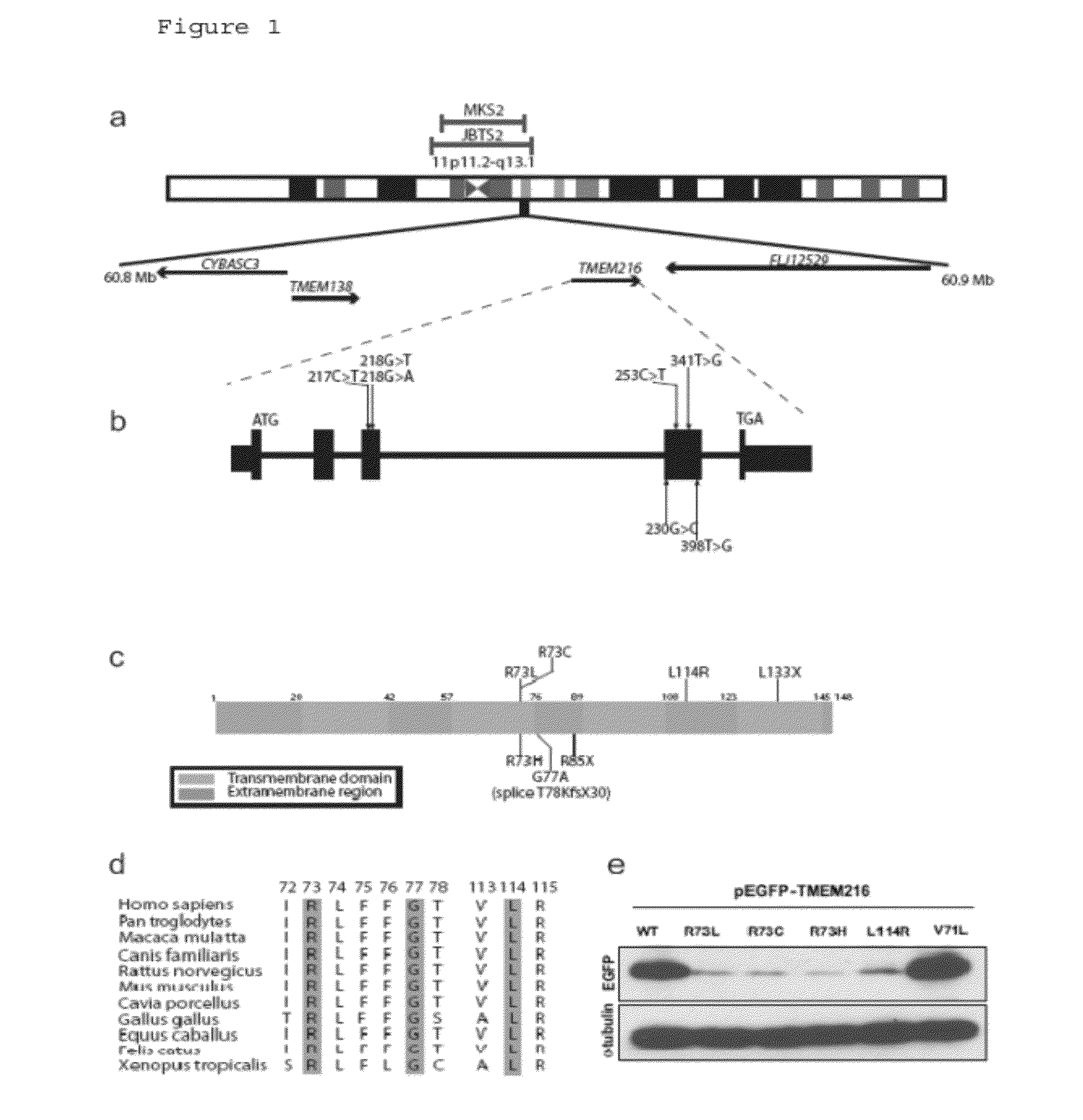 Compositions and methods for determining genetic polymorphisms in the tmem216 gene