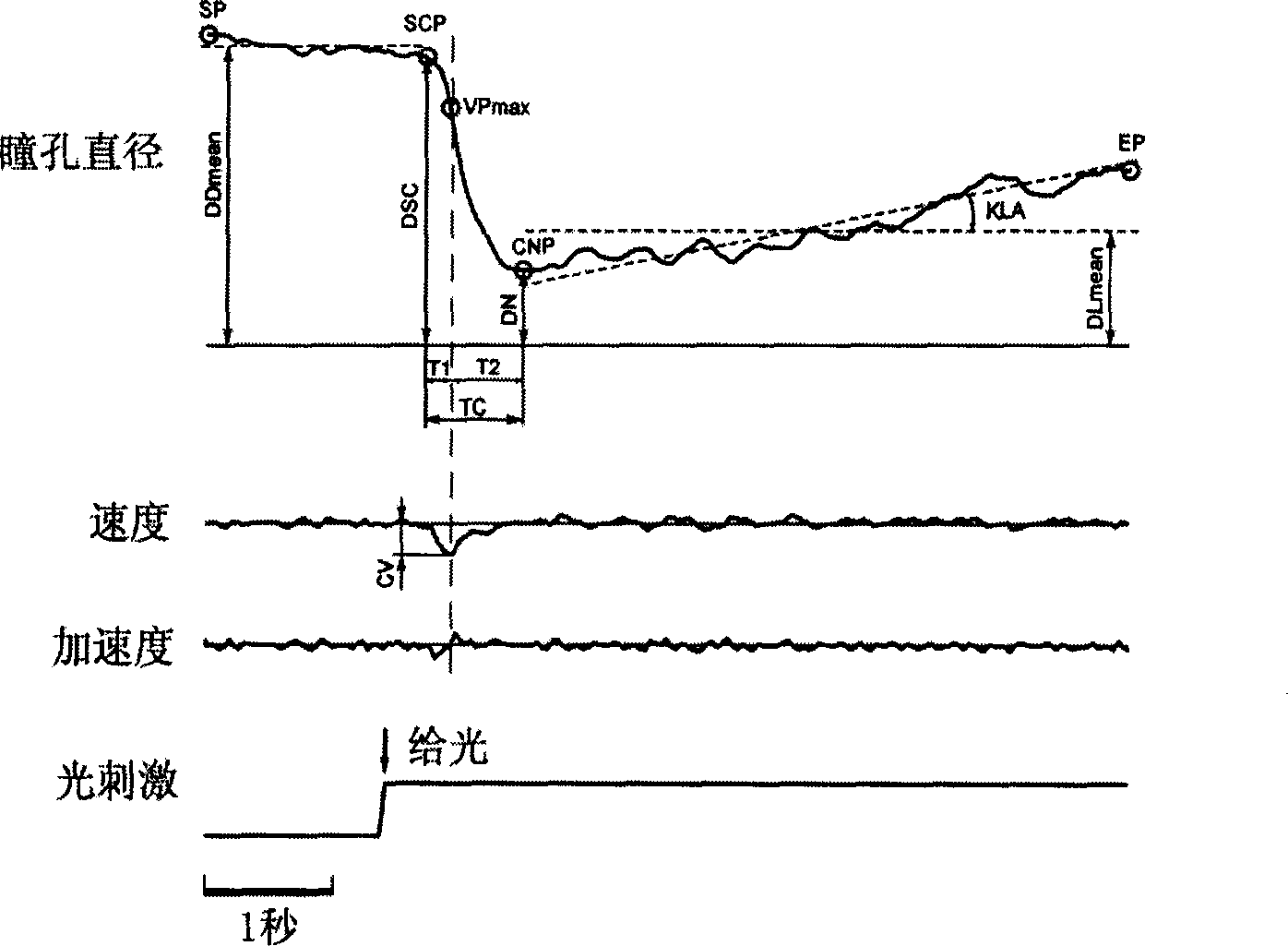 Digital system for detecting dynamic change of bilateral eye pupils