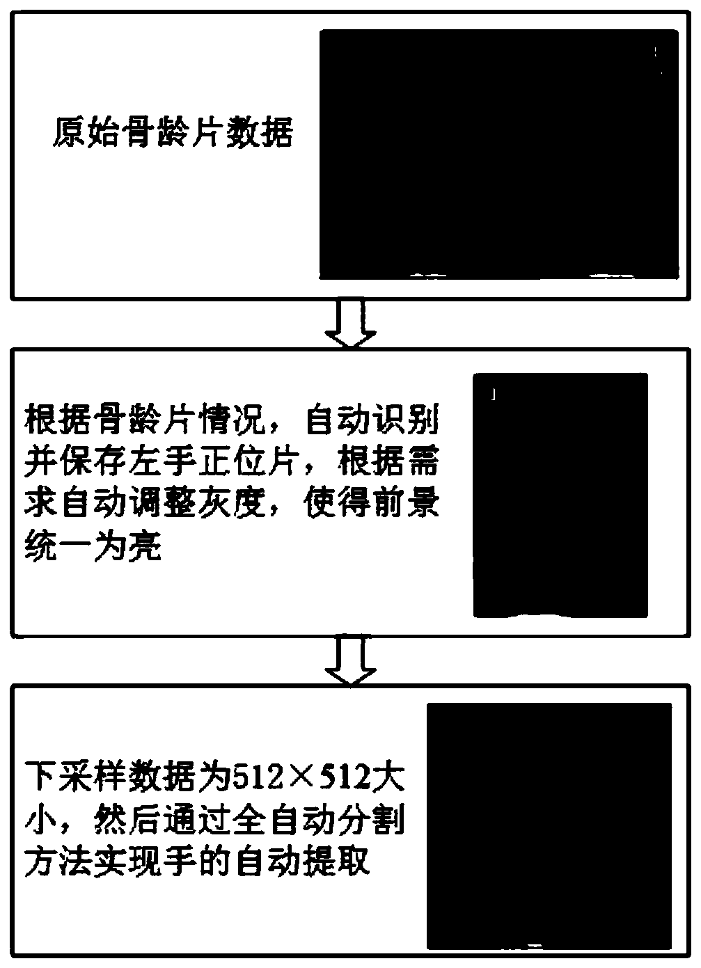 Full-automatic bone age evaluation method based on convolutional neural network