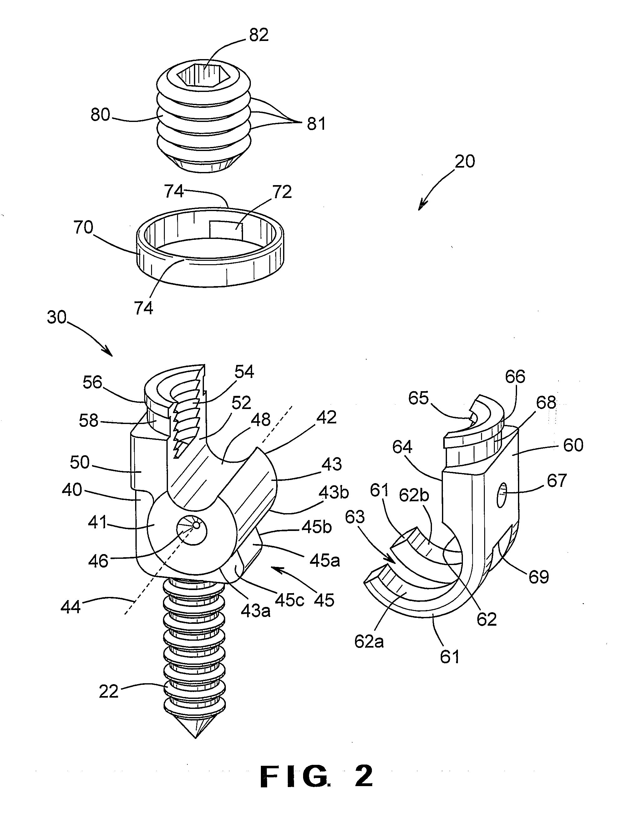 Pedicle screw including stationary and movable members for facilitating the surgical correction of spinal deformities