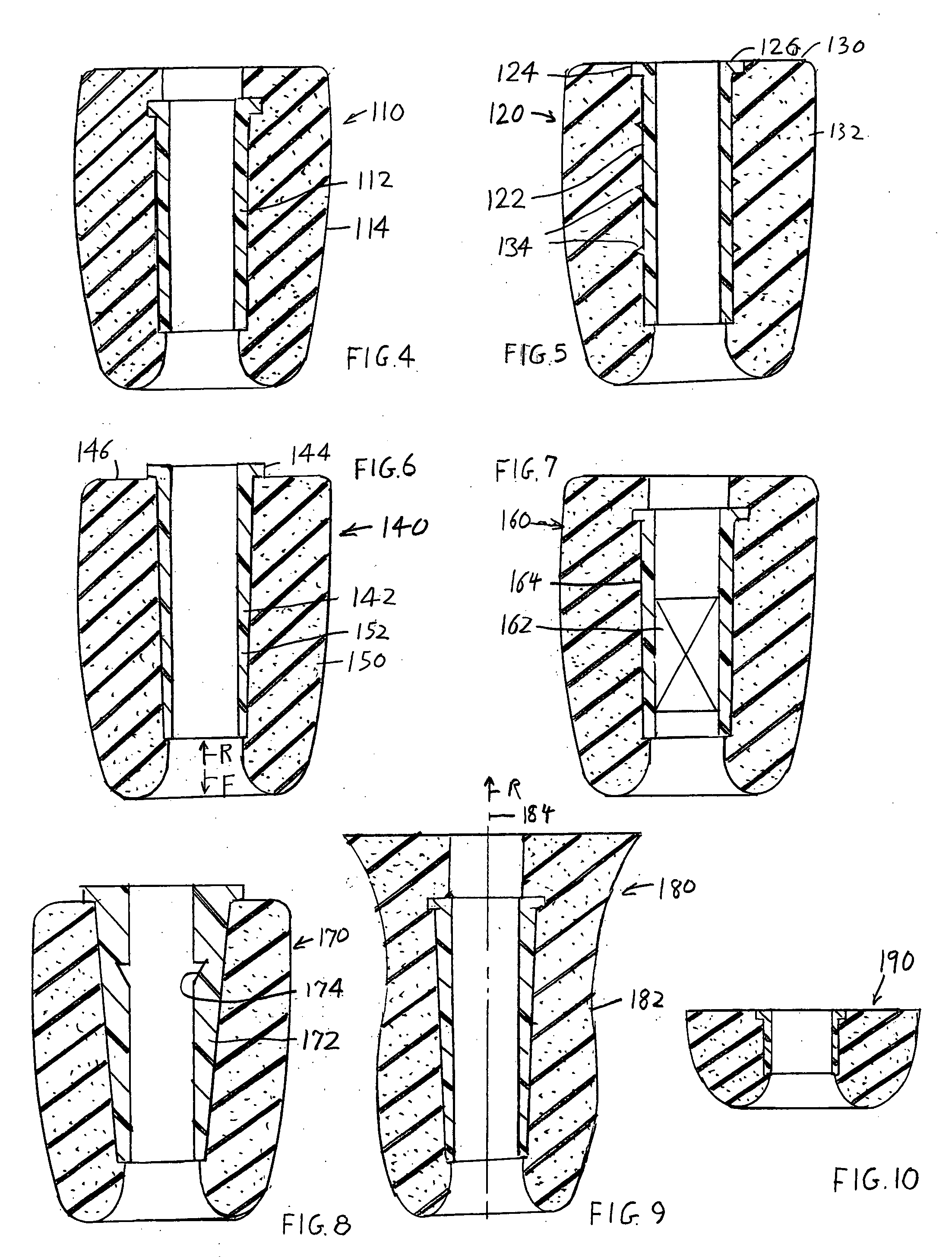 Earbud and method of manufacture