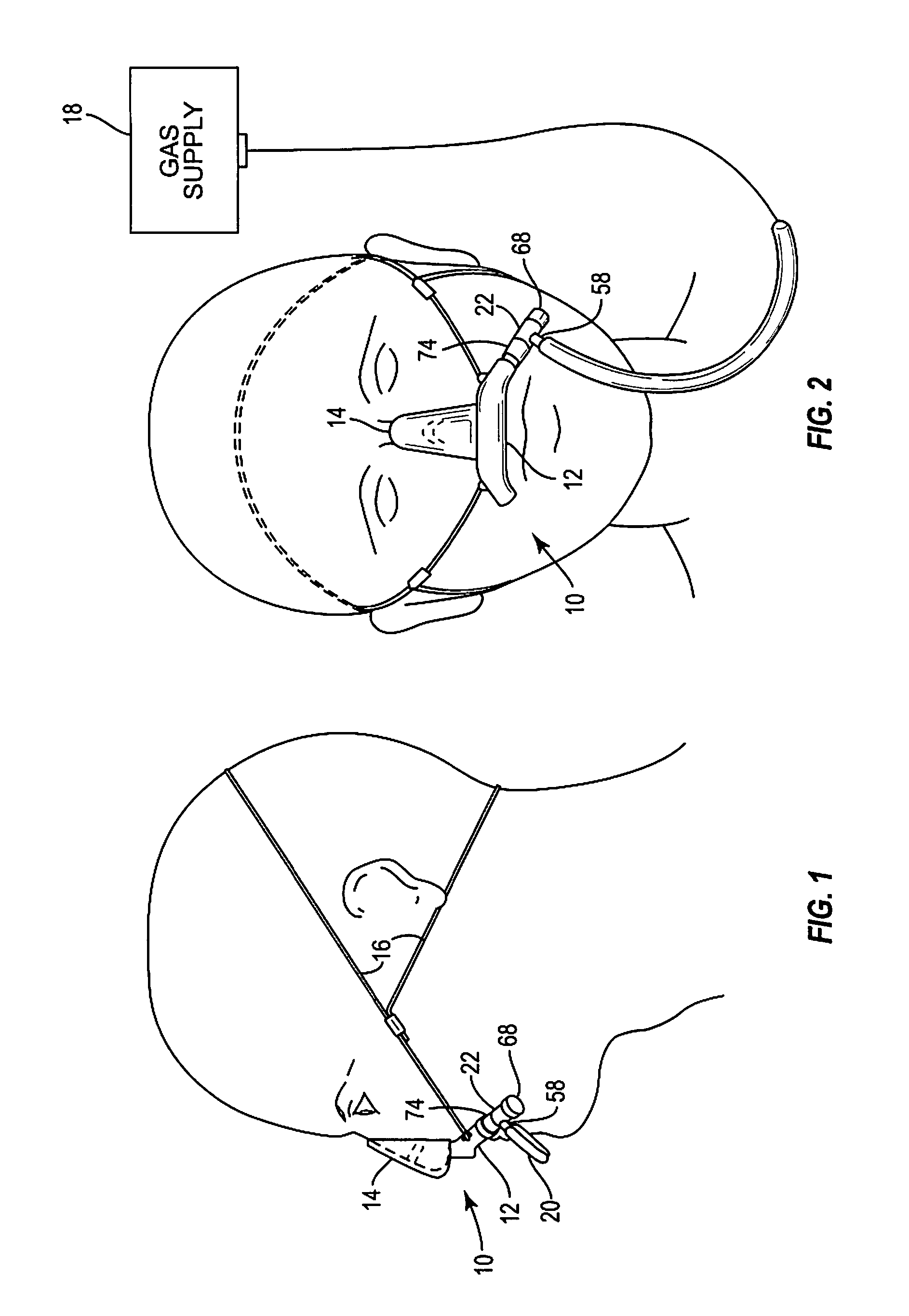 Inhalation apparatus