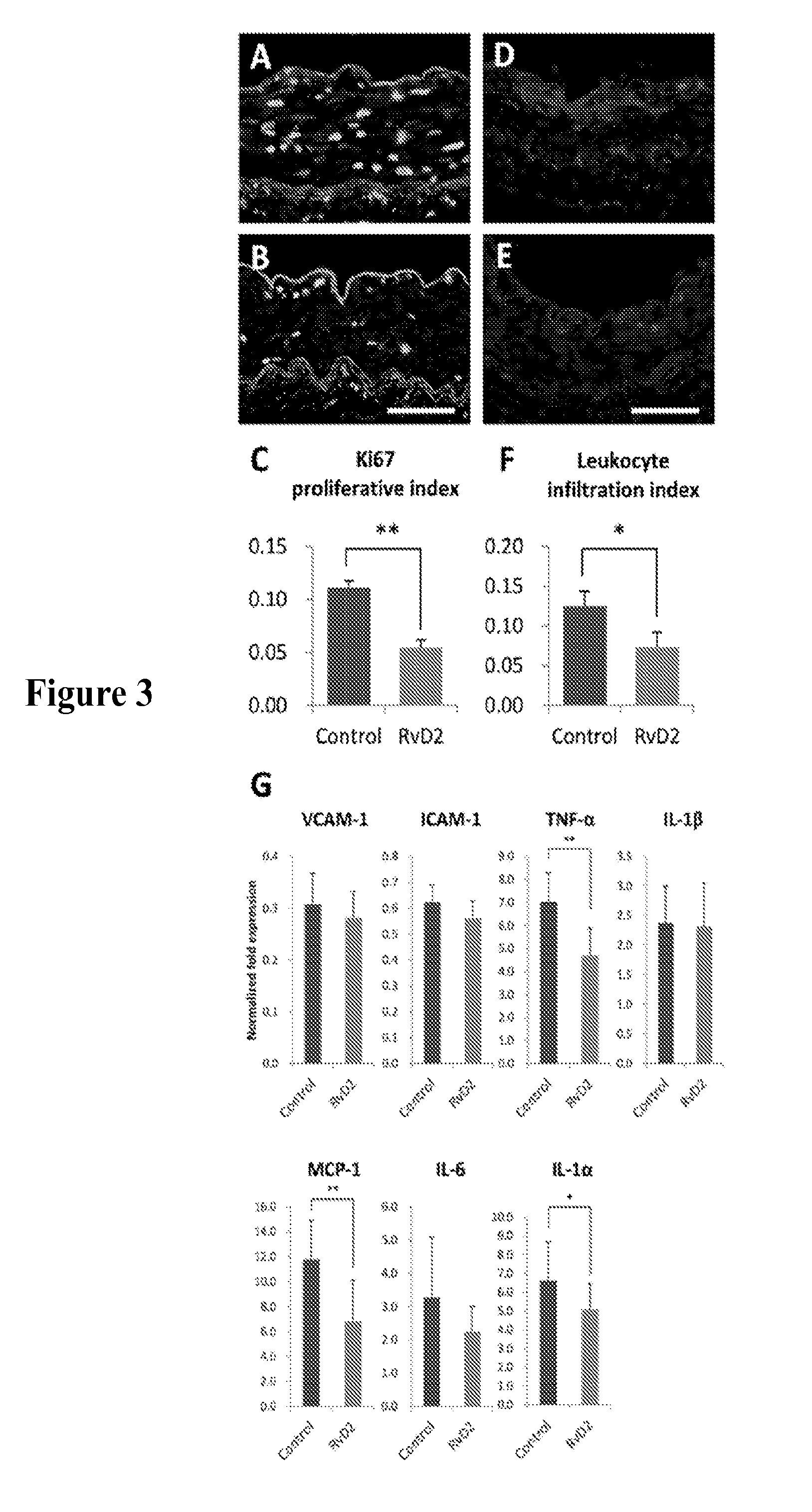 Compounds and methods for modulating vascular injury