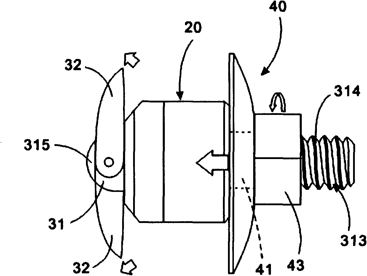 Supporting device of percutaneous expanding crest