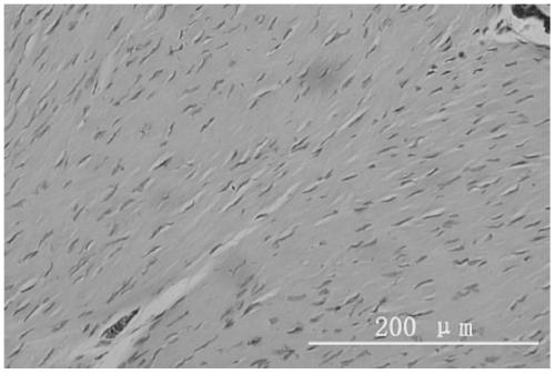 A preparation method of bacterial cellulose membrane tissue engineering artificial tendon scaffold