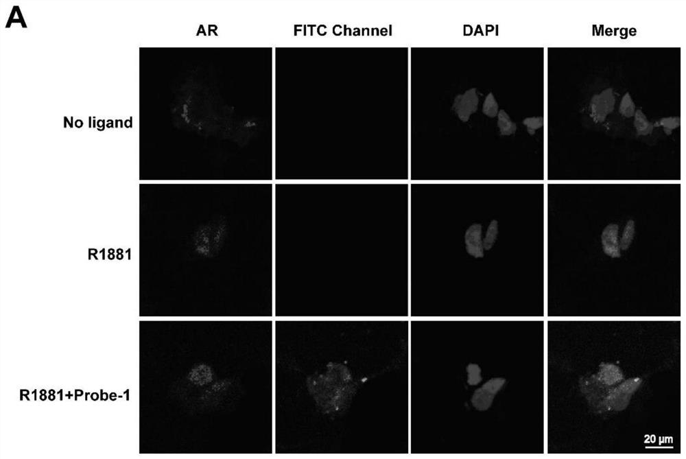 Androgen receptor micromolecular fluorescent probe as well as preparation method and application thereof