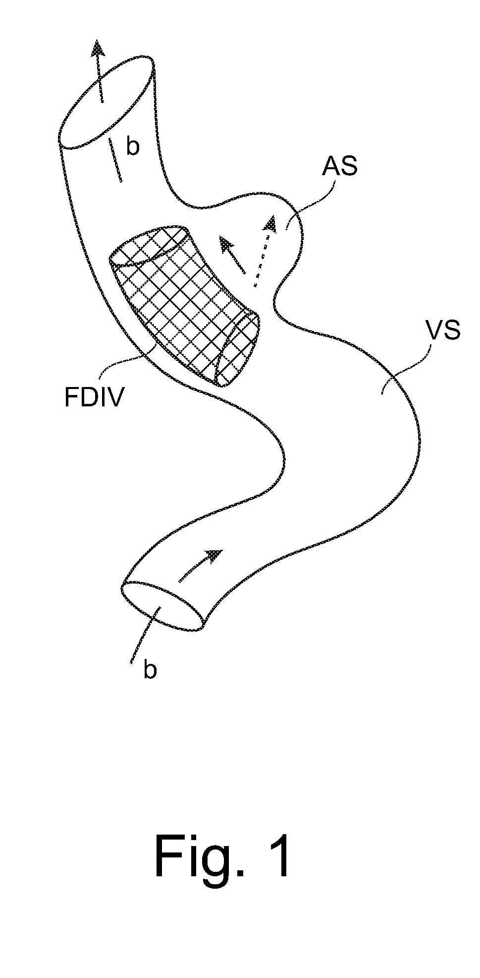 X-ray controlled contract agent injection