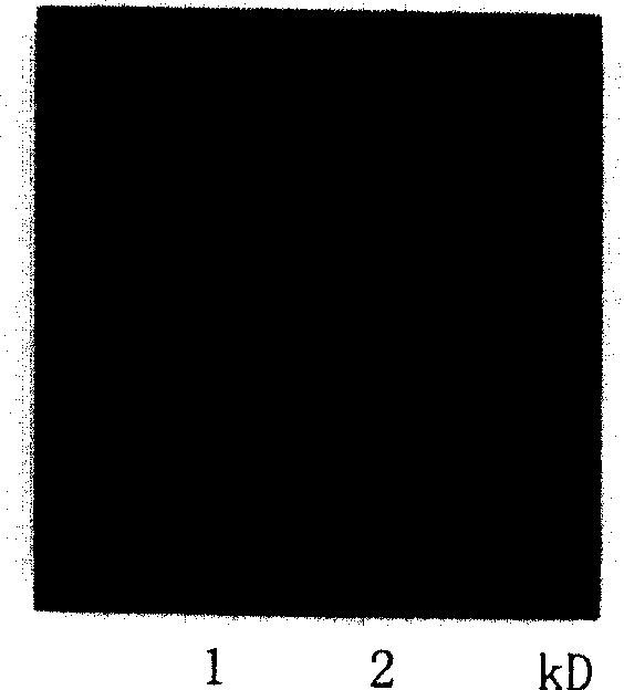 Low pyrogen staphylokinase and its preparation method