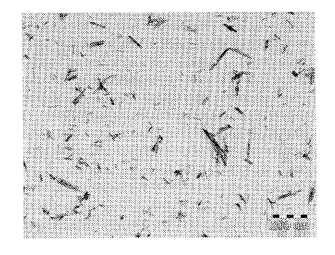 Gastro-resistant pharmaceutical oral compositions comprising duloxetine or its pharmaceutically acceptable derivatives