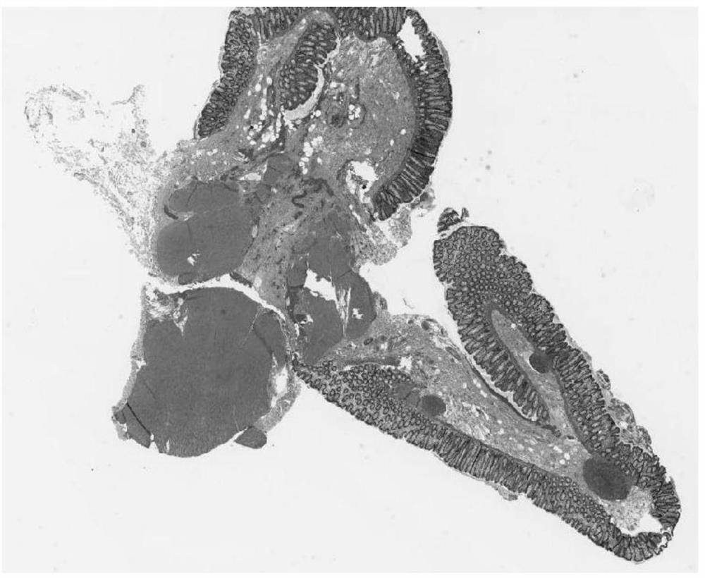 Tissue segmentation method for colorectal panoramic digital pathology images based on deep network