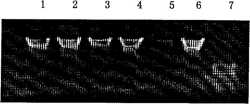 Method for extracting DNA from formalin-fixed tissue