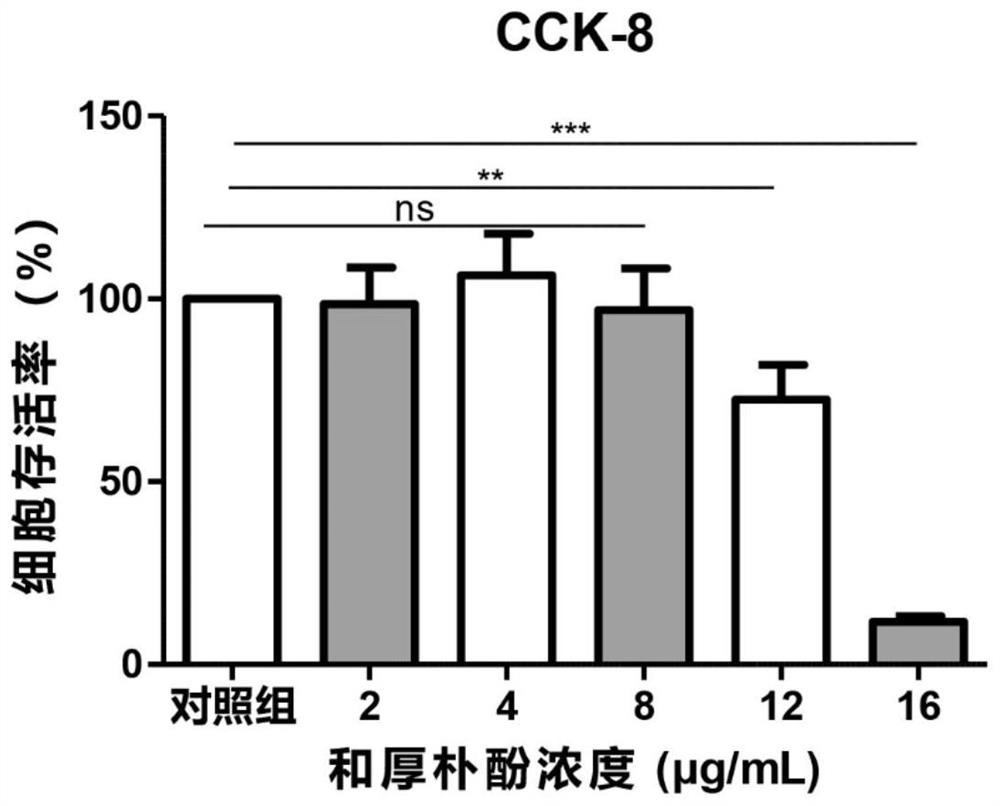 Preparation of honokiol ophthalmic medicine and application of honokiol ophthalmic medicine in treatment of fungal keratitis