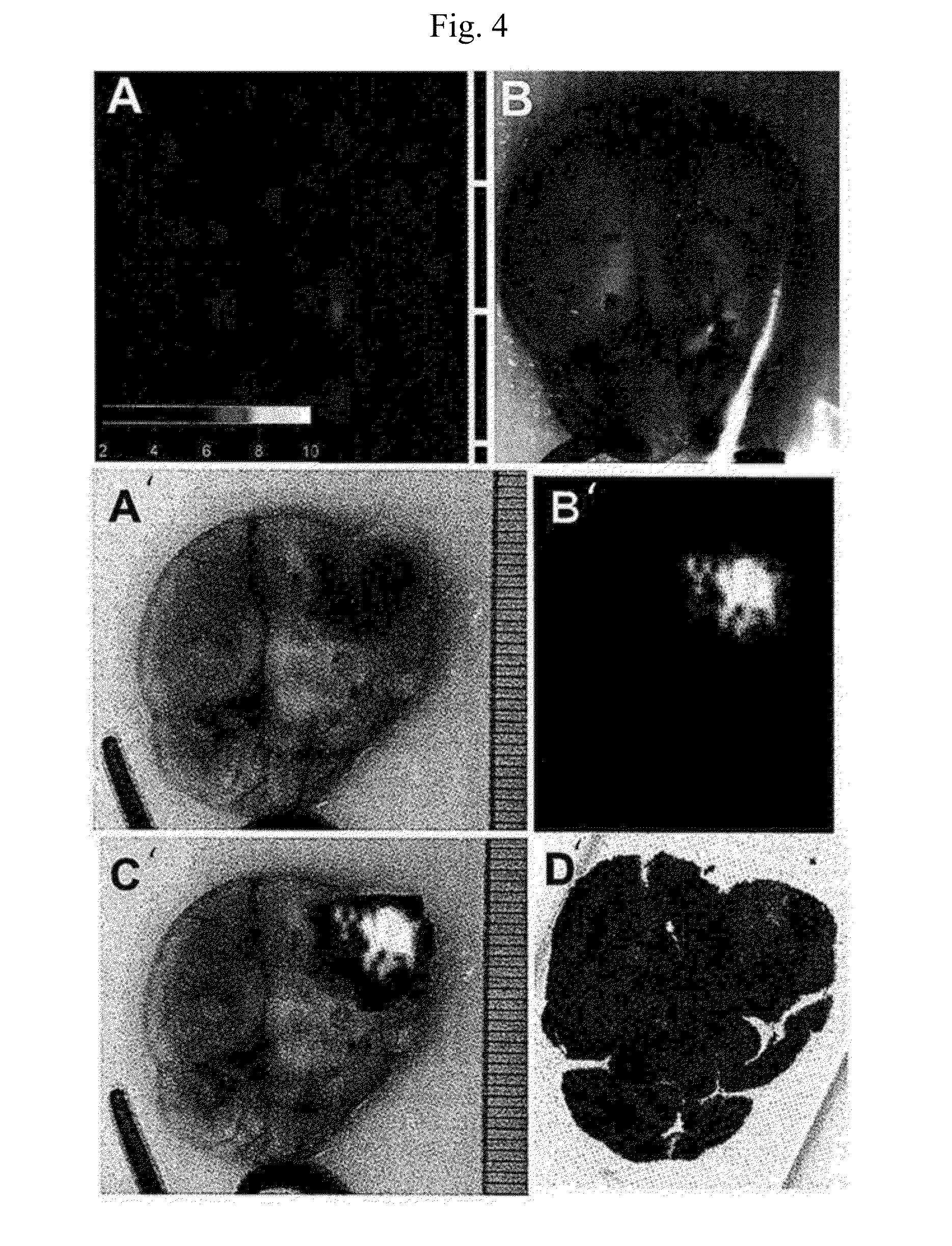 Phospholipid Ether Analogs as Cancer-Targeting Drug Vehicles