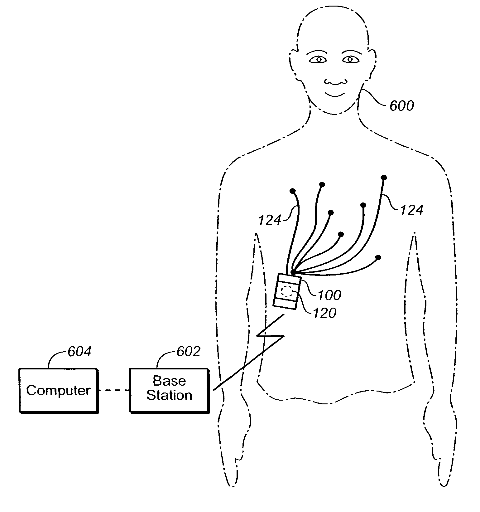 Portable cardiac monitor