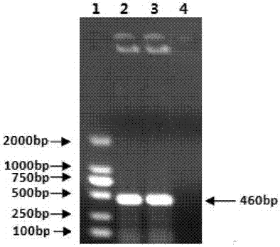 D-type toxigenic pasturella multocida vaccine strain for porcine atrophic rhinitis and application of strain