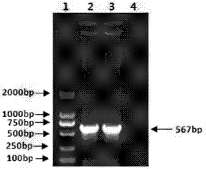 D-type toxigenic pasturella multocida vaccine strain for porcine atrophic rhinitis and application of strain