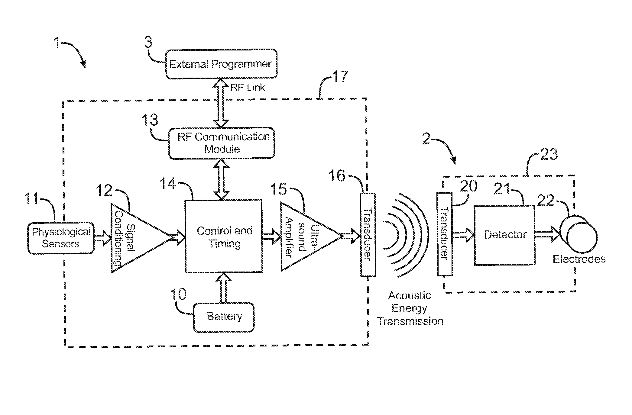 Systems and methods for implantable leadless brain stimulation