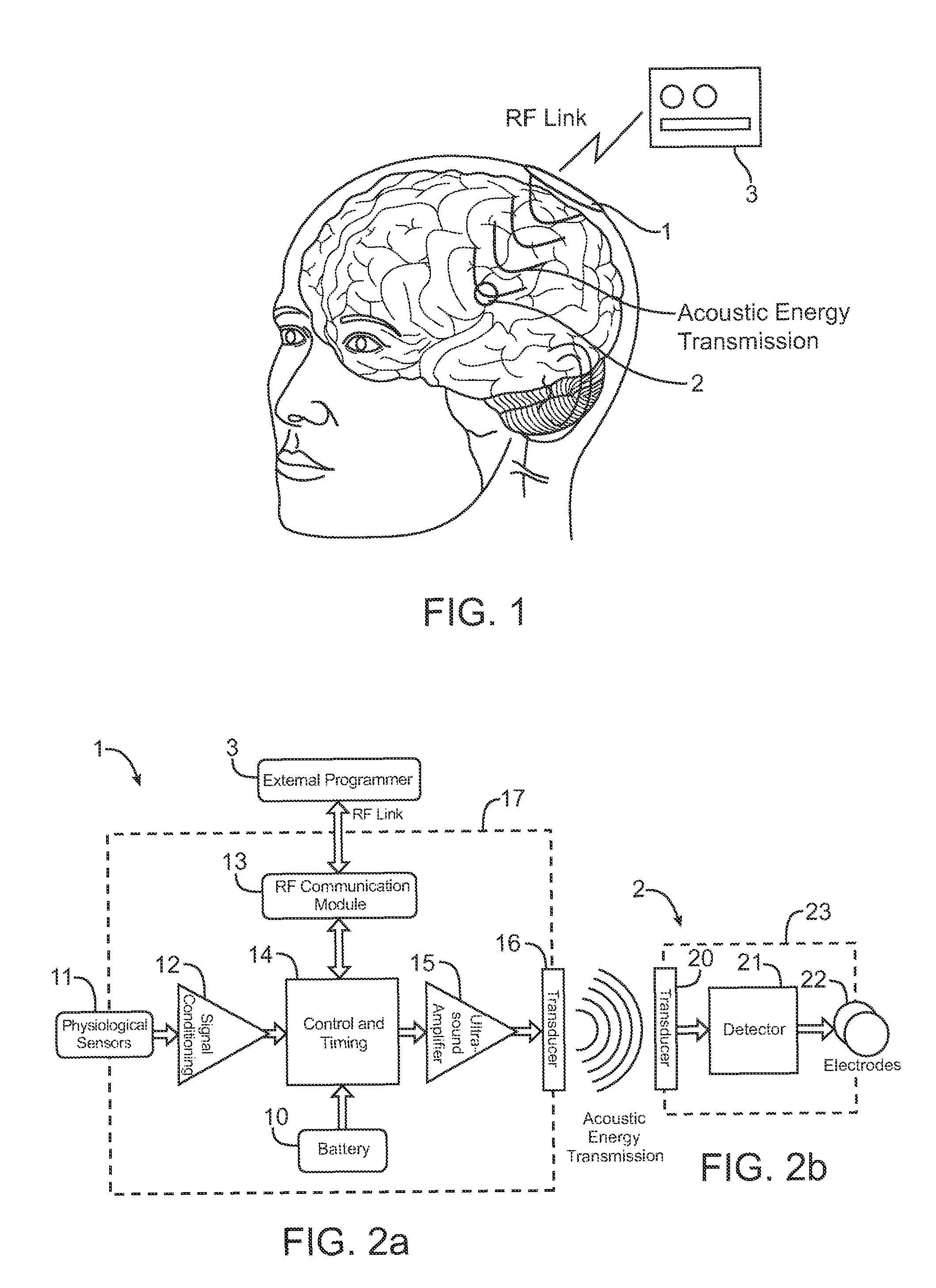 Systems and methods for implantable leadless brain stimulation