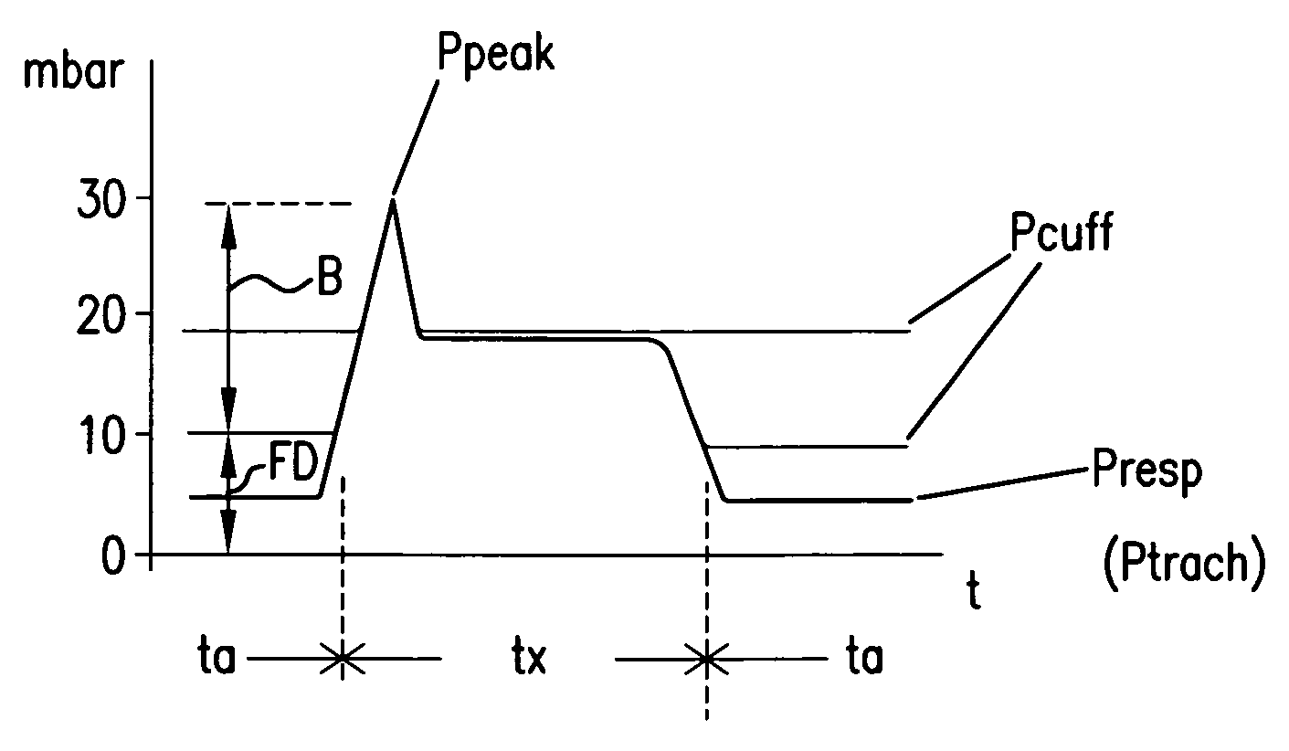 Method for controlling a ventilator, and system therefor