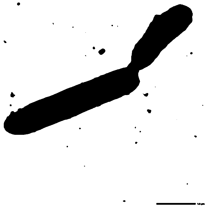 A strain of Rhodococcus and its application in degrading zearalenone