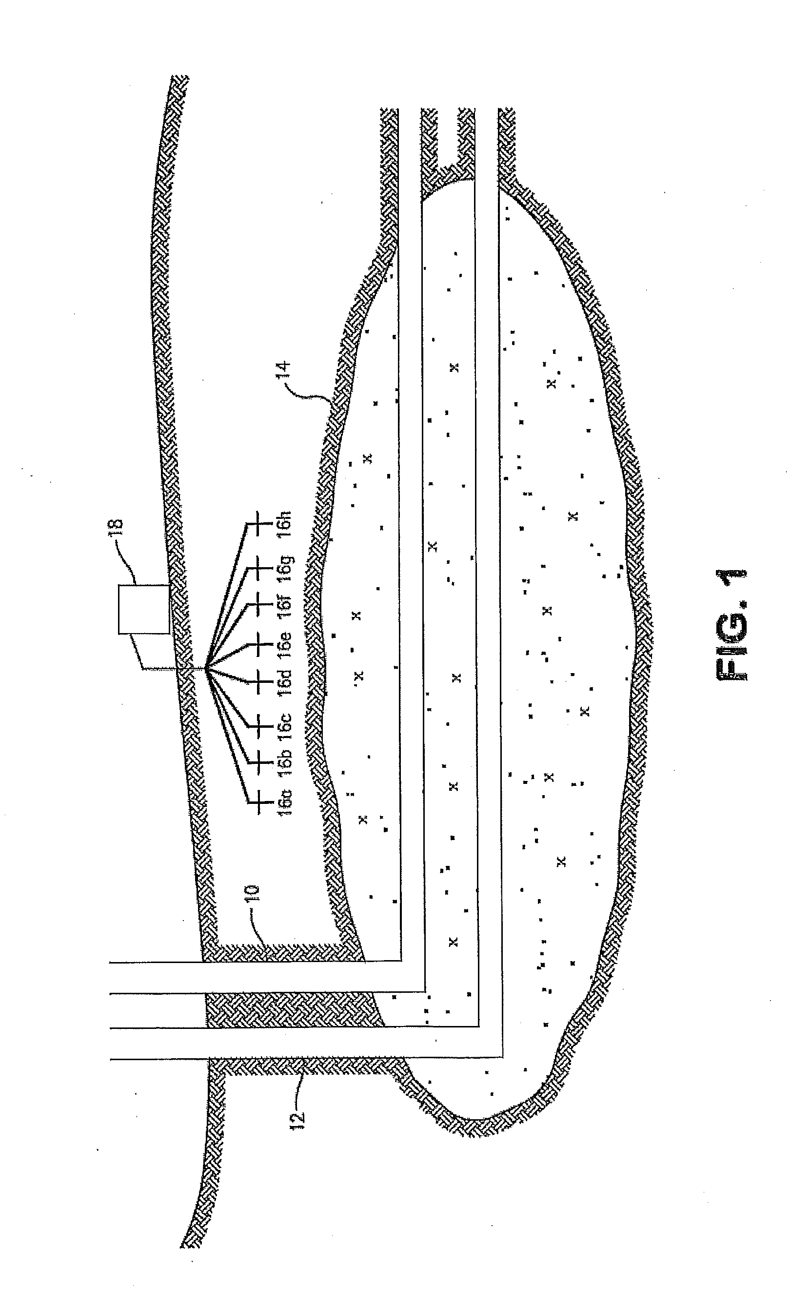 Accelerating the start-up phase for a steam assisted gravity drainage operation using radio frequency or microwave radiation