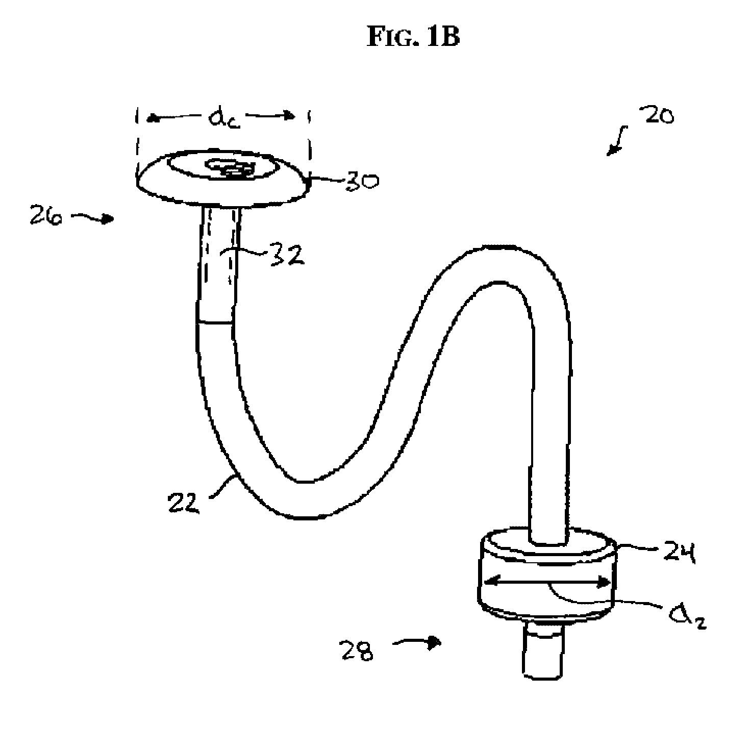 Electroactive polymer-based percutaneous endoscopy gastrostomy tube and methods of use