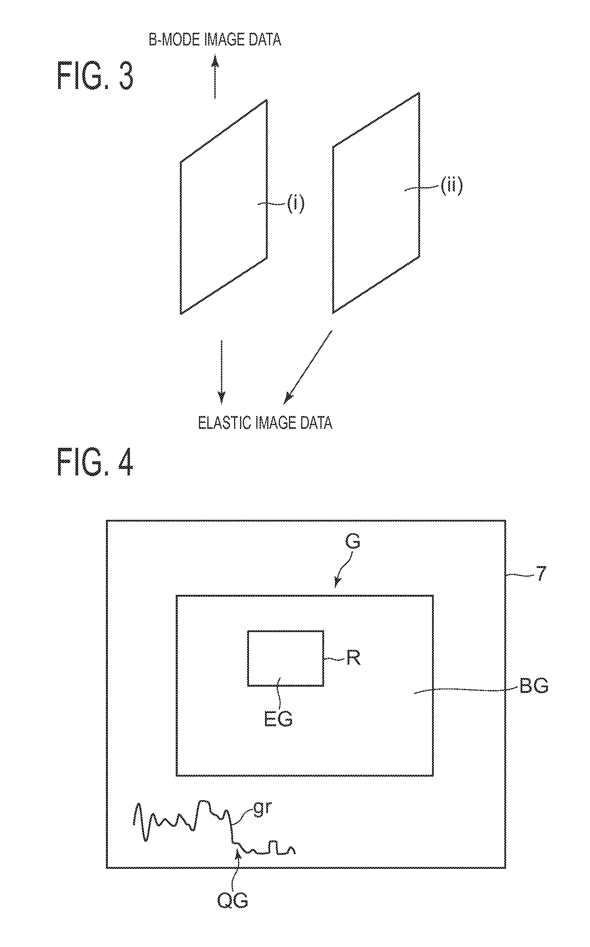 Ultrasonic diagnostic apparatus