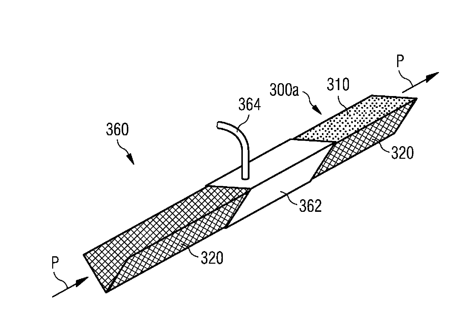 Formation of a core structure of a wind turbine rotor blade by using a plurality of basic core components