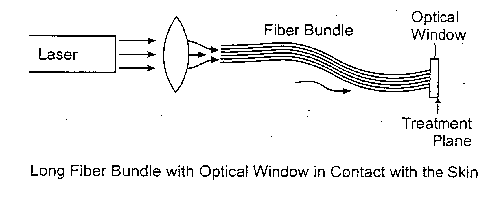 Methods and systems for laser treatment using non-uniform output beam