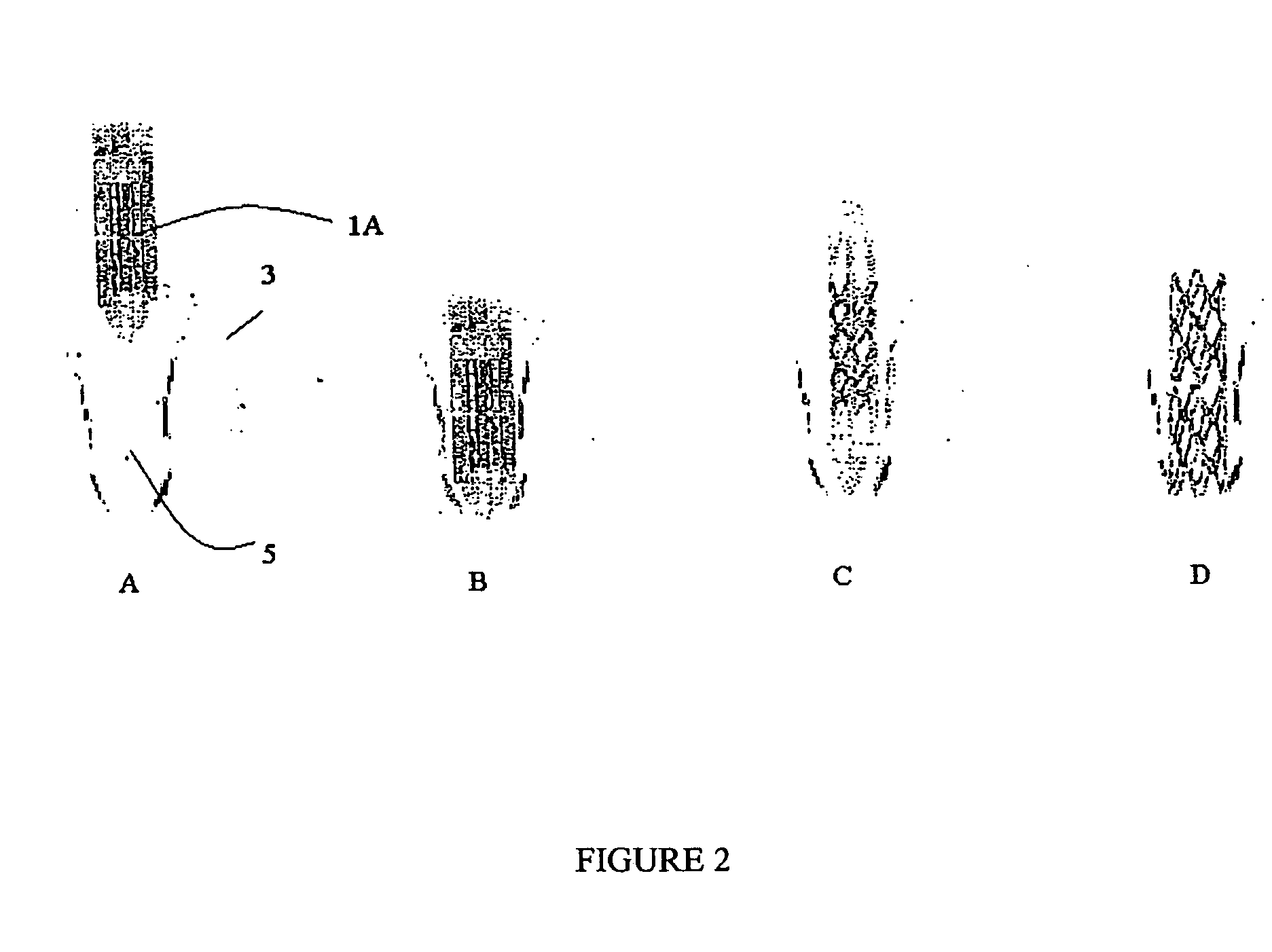 Polymeric dental implant