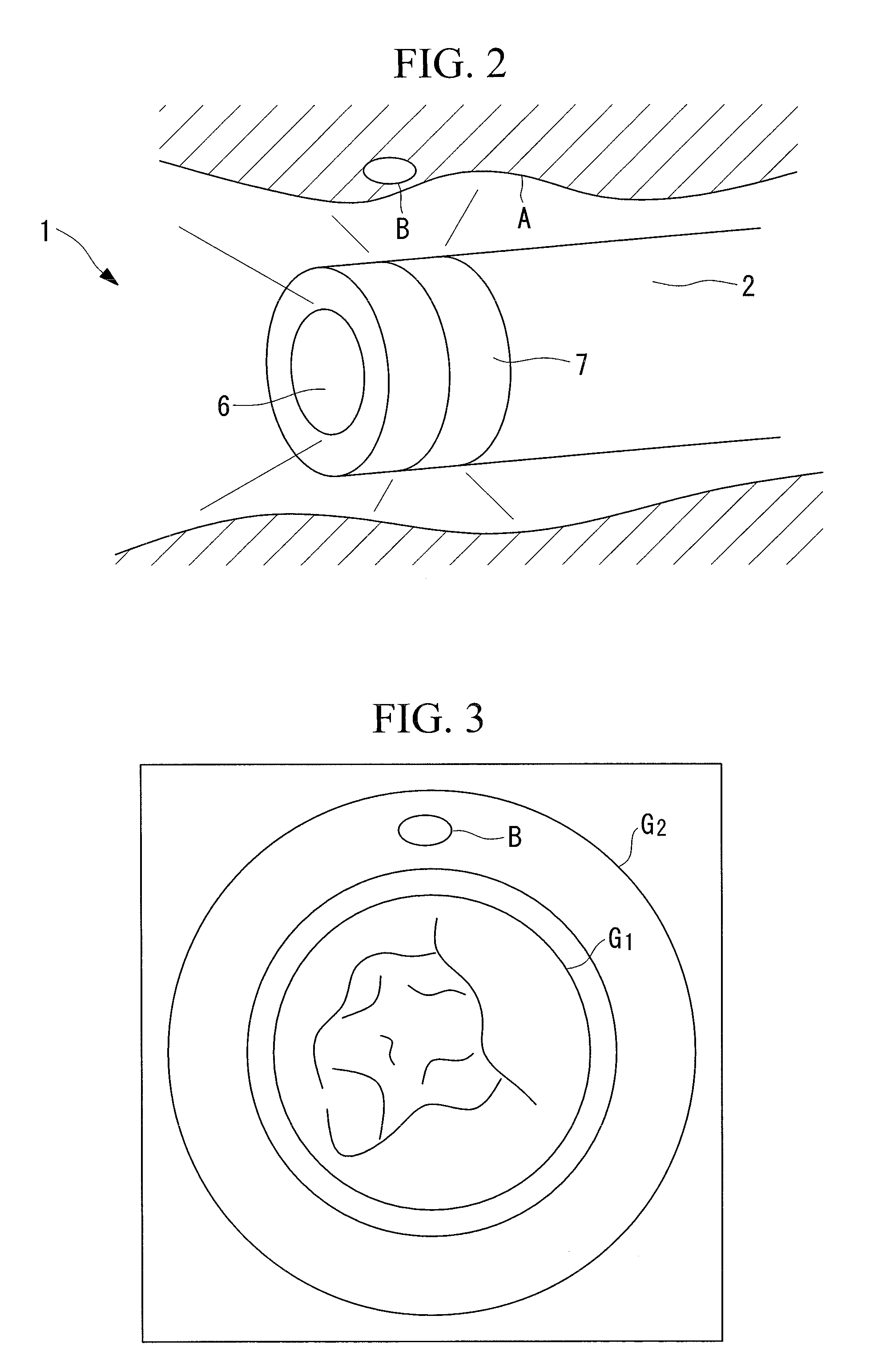 Endoscope apparatus