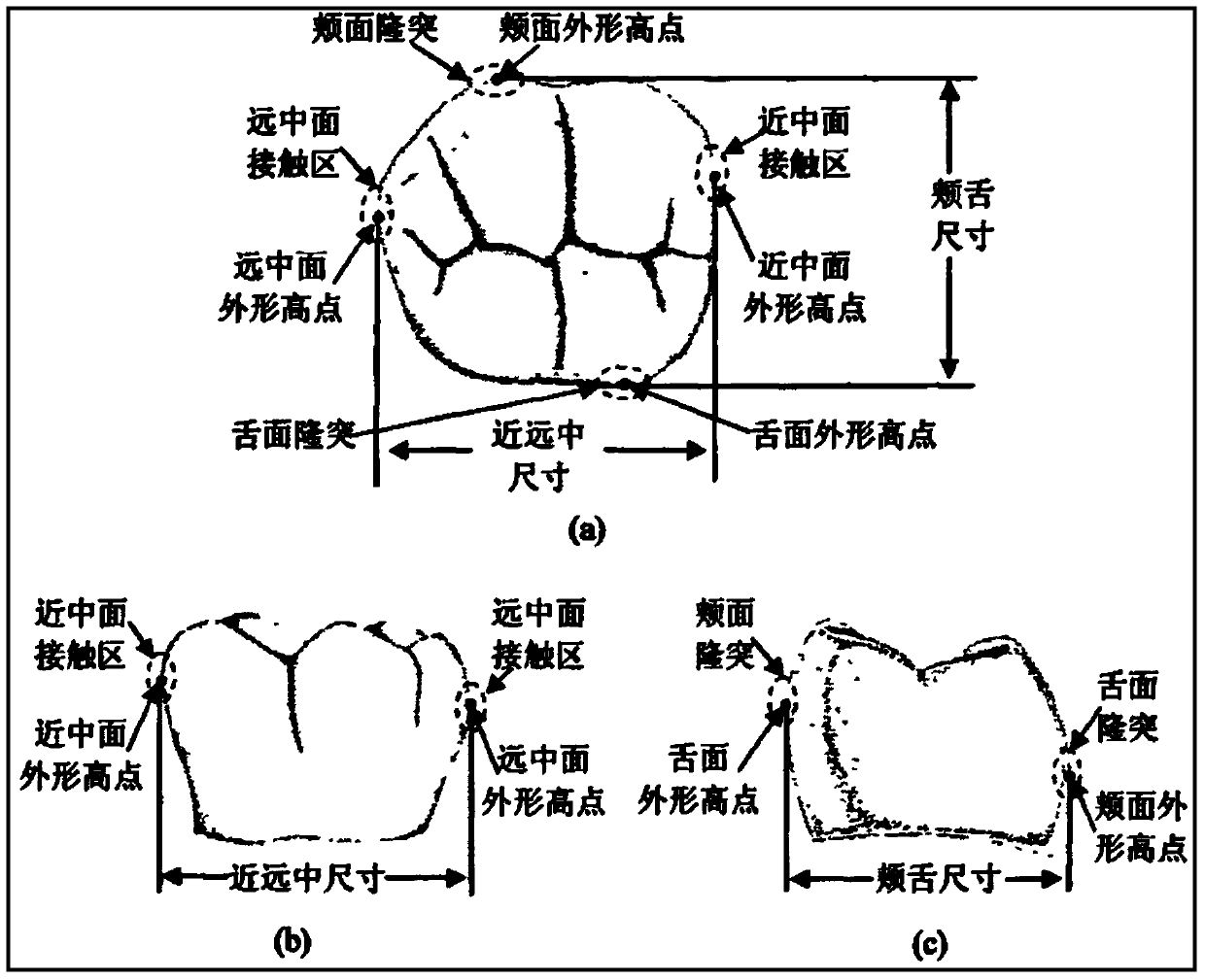 A Measuring Method of Form and Position Parameters of Digital Denture